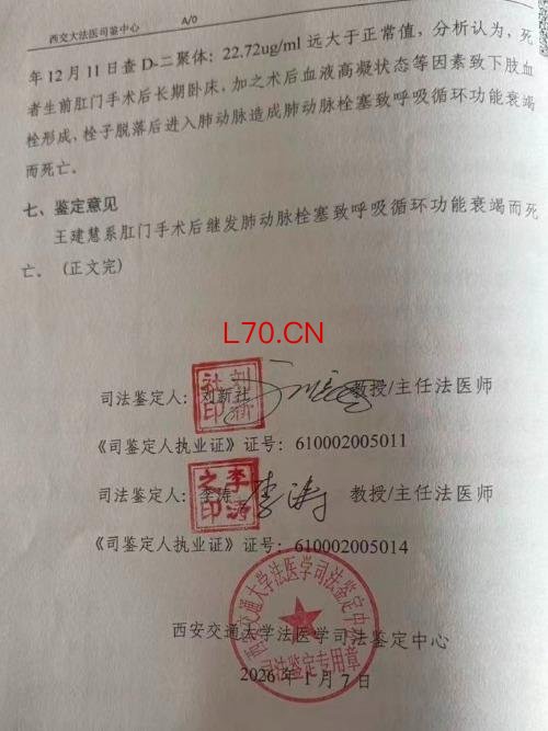 痔疮手术9天后死亡医院只赔1万